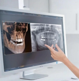 Компьютерная томография зубов - Сүрөт 1