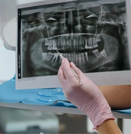 Панорамный рентген зубов - Сүрөт 1